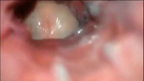 Анал с членом изнутри