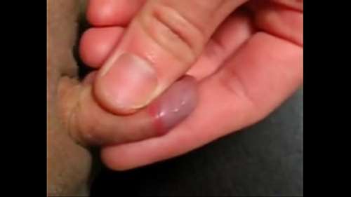 Большой клитор или маленький член?